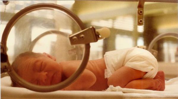 bebelusi prematuri tratati cu cafeina si viagra