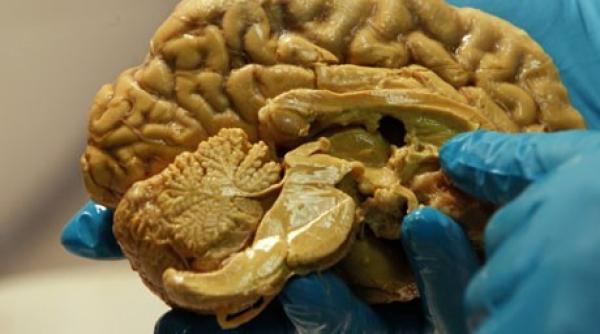 mister creierul lui einstein furat si pastrat timp de 50 de ani