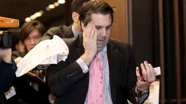 coreea de nord dupa agresiunea asupra lui mark lippert o pedeapsa meritata