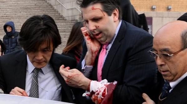 mark lippert ambasadorul sua la seul ranit dupa ce a cazut victima unui atac