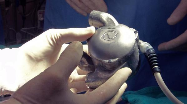 cum functioneaza prima inima bionica din lume nu are puls si este facuta din titan