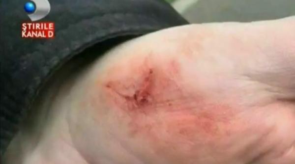 medicul nicolae bacalba a ranit de un tigru la gala i