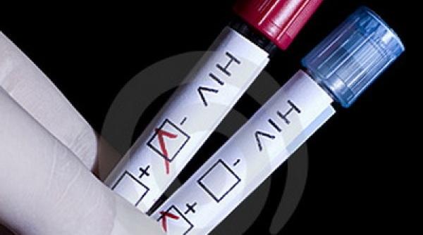 hiv  virusul care cauzeaza sida  cum se raspandeste in organism