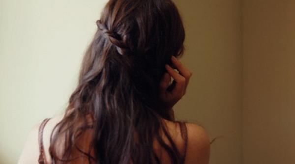 o noua tehnica de transplant de par testata cu succes