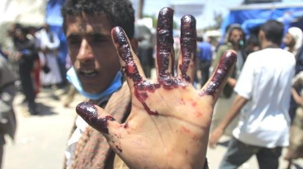 arabia saudita pune capat bombardamentelor din yemen