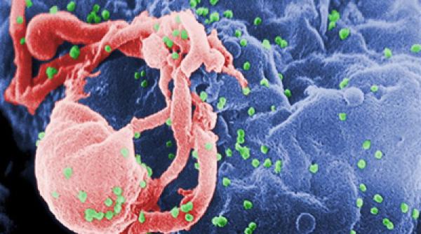 noua terapie anti hiv realizata cu anticorpi naturali ofera rezultate promitatoare