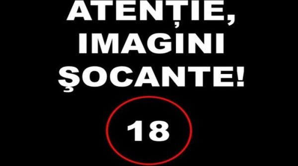 ingrozitor accidentare oc a unui fotbalist video