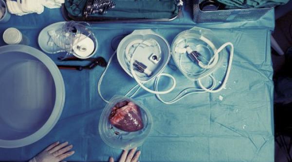 oc in medicina o a doua persoana cu inima artificiala a murit