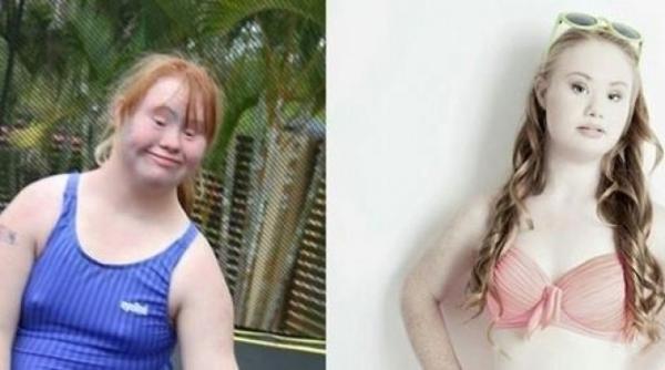 tanara care sparge toate tiparele un fotomodel cu sindrom down