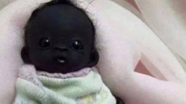 cum arata bebelu ul cu cea mai inchisa la culoare piele din lume