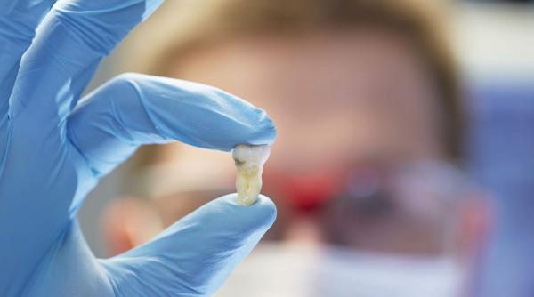 banala carie dentara cre te riscul unei boli devastatoare