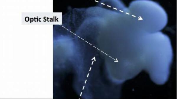 replica creierului uman realizata in laborator in sua