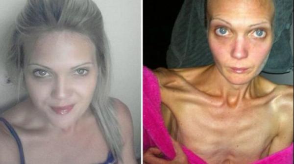 vestea cumplita care a facut o sa ajunga la doar 34 kg