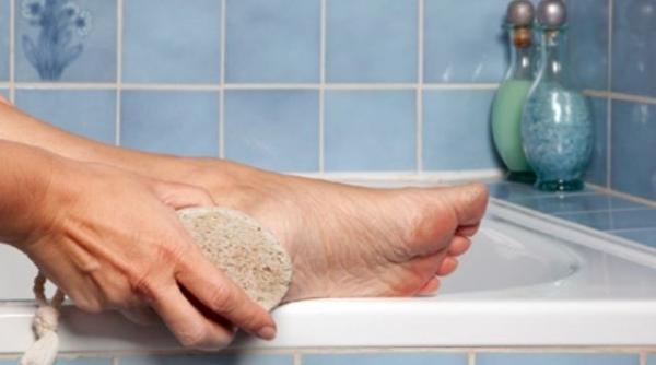 cel mai simplu remediu pentru calcaiele crapate