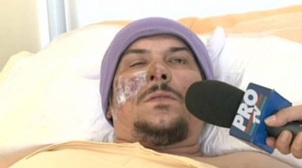 supravie uitor al incendiului din colectiv doua maini m au tras din infern