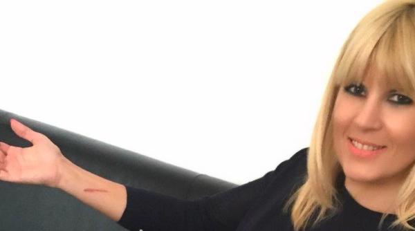 elena udrea zgariata pe mana sunt sigura ca regreta a a ca