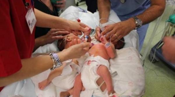 siamezele din constanta au murit la spitalul marie curie