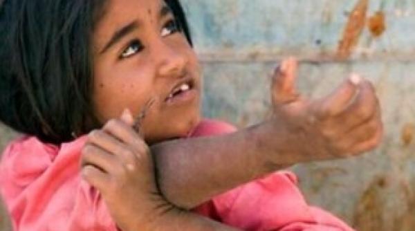 ciolos  eforturile administrative pentru integrarea romilor nu sunt suficiente