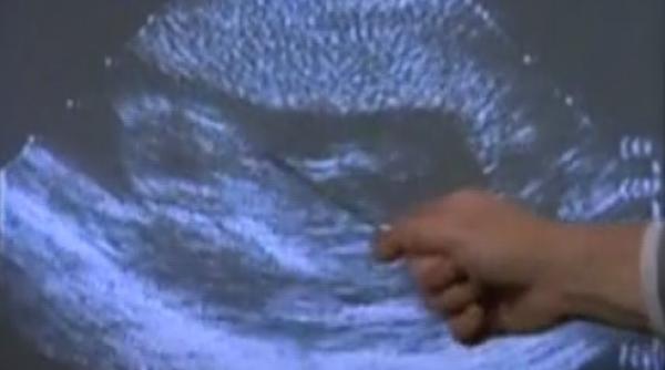 profesorul de religie explica ii privind filmul despre avorturi prezentat elevilor la ora