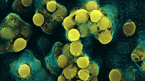 bacterie periculoasa descoperita intr un spital dupa moartea a doi bebelu i