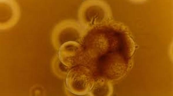 un cunoscut supermodel diagnosticat cu cancer sa nu va para pentru mine