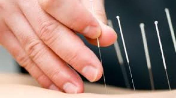 acupunctura in cazul durerii de spate de ce nu mai este recomandata