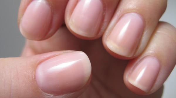 ce sunt liniile albe de pe unghii