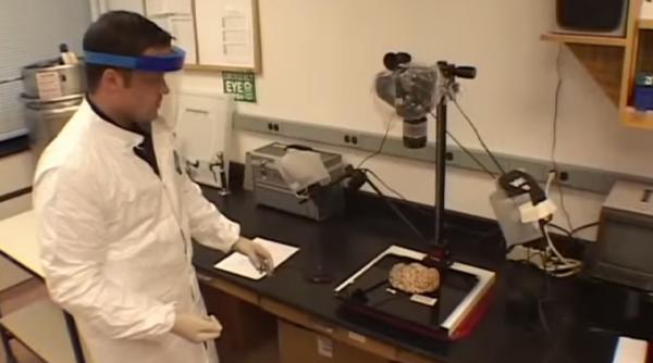 cea mai mare banca de creiere numar impresionant de mostre stocate