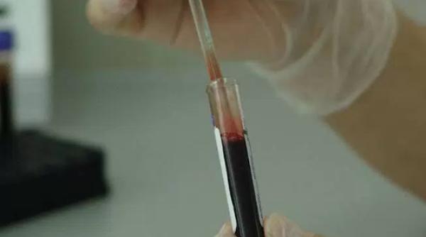 mitul pacientului zero spulberat studiul care da totul peste cap constatari uimitoare