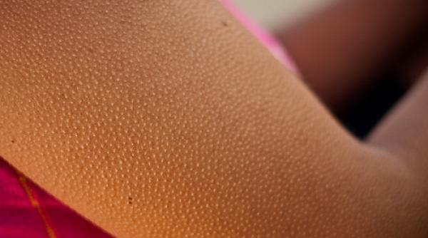 de ce ti se face pielea de gaina cand iti este frig