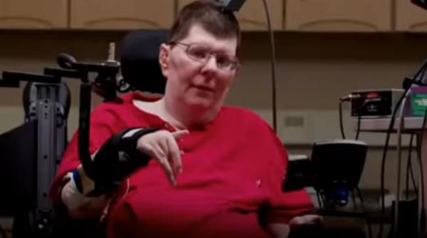 premiera medicala un barbat paralizat i a folosit mana cu puterea min ii