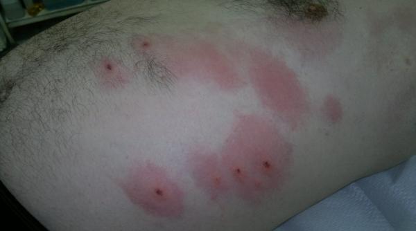 medic upu 13 lucruri importante despre mu caturile de capu e