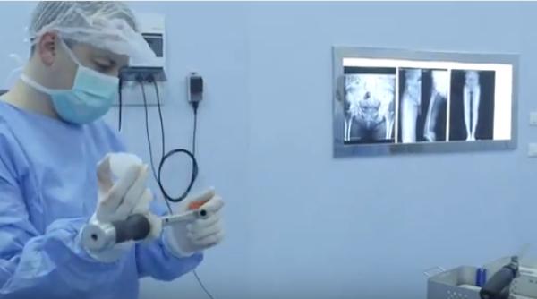 premiera in lumea medicala din romania opera ie cu o proteza de top video