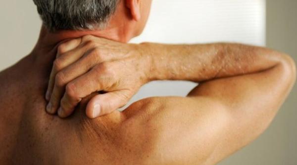 bancul zilei cum este cu spondiloza