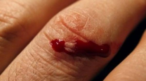 de ce ranile se vindeca mai greu la unii oameni studiu