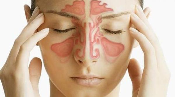 sinusuri inflamate remediu fara medicamente