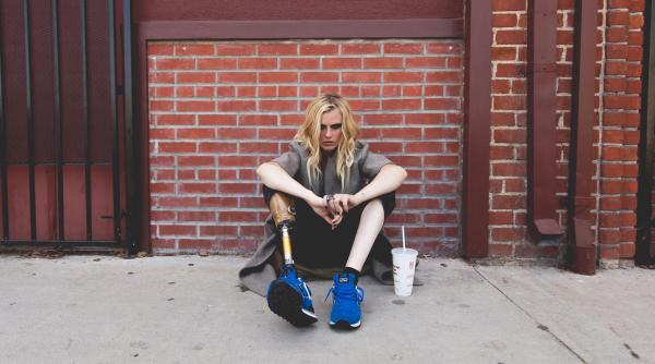 lauren wasser operatie picior