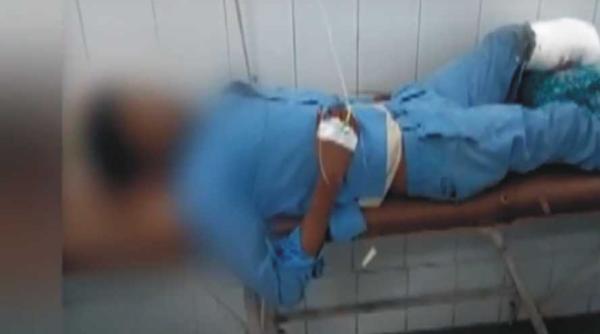 socant picior amputat folosit ca perna in spital video