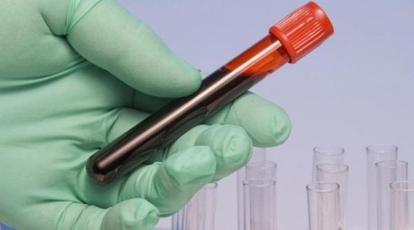 imunoglobulina remus borza antaj al marilor producatori de medicamente gre eala romaniei