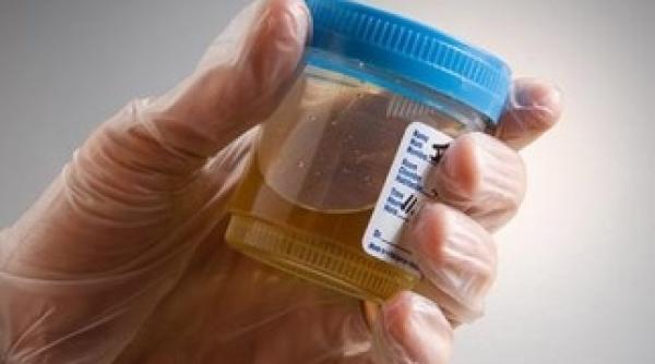 test droguri urina falsa noul truc de pe pia a metoda de necrezut