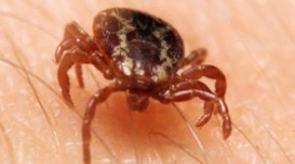 mu catura de capu a 5 lucruri de facut imediat