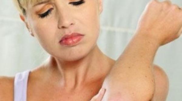 psoriazis acces ingreunat la tratament pentru pacien i