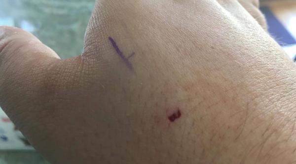 cip implanturile inteligente la om tot ce trebuie sa tii