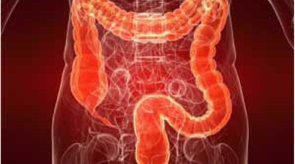 cancerul colorectal depistare prof dr cristian gheorghe interviu