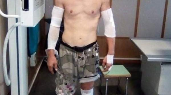 explozie italia romanul ranit acesta este motivul