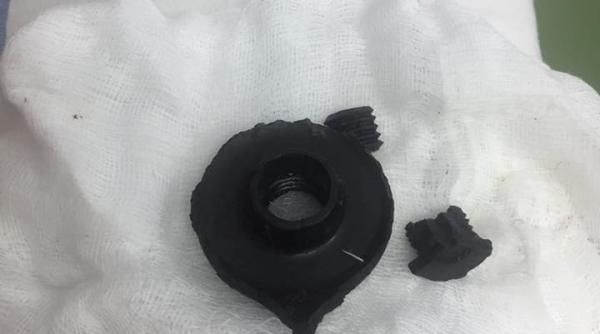 pacientul operat la spitalul universitar asta au scos din mine