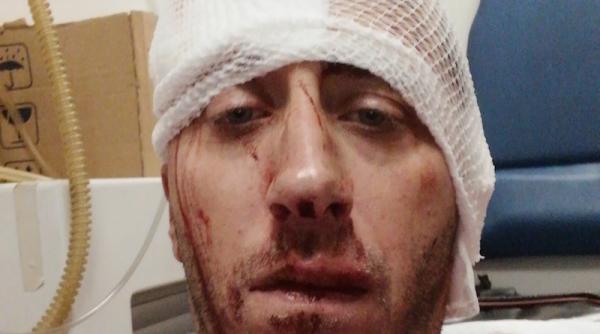 jurnalist sarb lovit cu brutalitate de indivizi cu cagule in bosnia