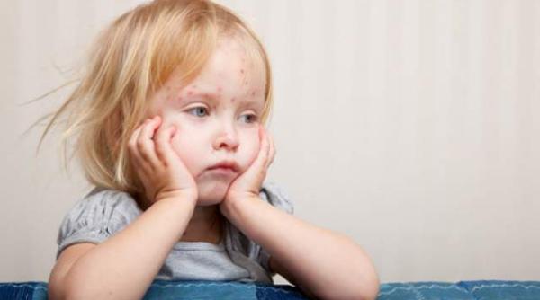 alerta la scoala zeci de copii trimisi acasa boala contagioasa