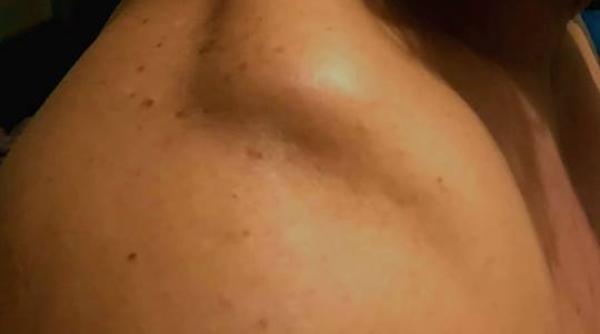 pepe s a accidentat grav fanii sunt socati