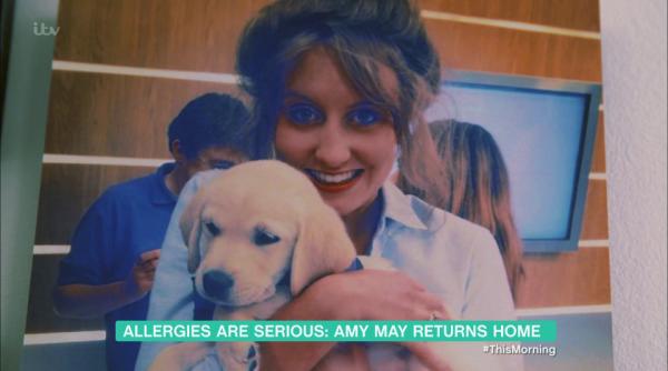 socant o tanara a devenit invalida dupa ce a muscat dintr o bucata de pui